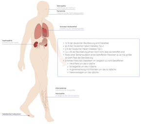 Diabetes Ausbreitung & Verbreitung