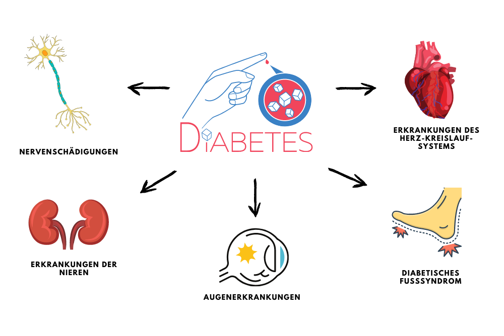 Augenerkrankungen, Erkrankungen des Herz-Kreislauf-Systems, Nervenschädigungen - Diabetes kann vieles auslösen Begleiterkrankungen von Diabetes im Überblick